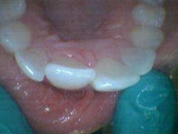 14febsrrsimmonsdentaltrauma05 14febsrrsimmonsdentaltrauma05