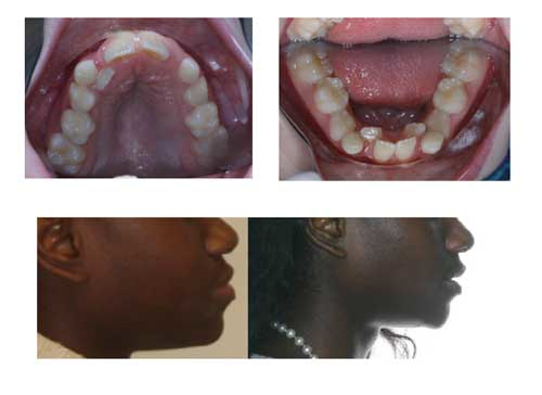 14jansrrfaberextract