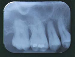 14jansrrgardonmollard02 14jansrrgardonmollard02