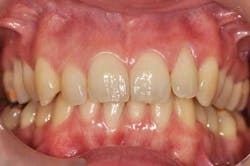 14jansrrgardonmollard03 14jansrrgardonmollard03