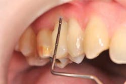 14jansrrgardonmollard04 14jansrrgardonmollard04