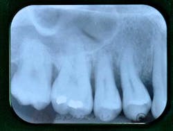 14jansrrgardonmollard06 14jansrrgardonmollard06