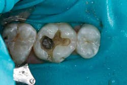 14jansrrteel03 14jansrrteel03