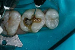 14jansrrteel06 14jansrrteel06