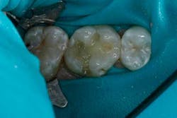 14jansrrteel11 14jansrrteel11