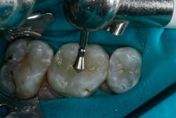 14jansrrteel15 14jansrrteel15