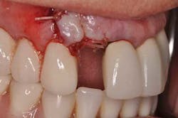 14jul10srrsaliernoflipper02 14jul10srrsaliernoflipper02