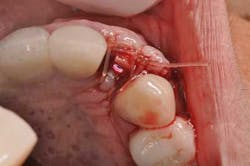 14jul10srrsaliernoflipper03 14jul10srrsaliernoflipper03