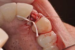 14jul10srrsaliernoflipper04 14jul10srrsaliernoflipper04