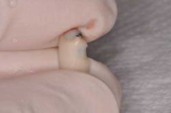 14jul10srrsaliernoflipper05 14jul10srrsaliernoflipper05