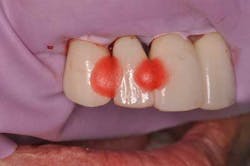 14jul10srrsaliernoflipper06 14jul10srrsaliernoflipper06