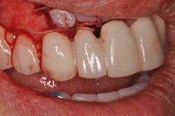 14jul10srrsaliernoflipper07 14jul10srrsaliernoflipper07