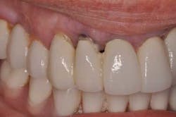 14jul10srrsaliernoflipper08 14jul10srrsaliernoflipper08