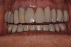 14jul10srrsaliernoflipper10 14jul10srrsaliernoflipper10