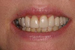 14jul24srrbearapicposflap02 14jul24srrbearapicposflap02