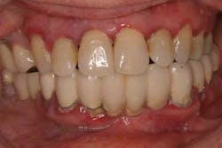 14jul24srrbearapicposflap03 14jul24srrbearapicposflap03