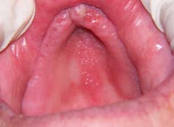 14jun12srrlukesgeriatric03 14jun12srrlukesgeriatric03