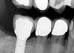 14jun12srrsimmonspumpkin02 14jun12srrsimmonspumpkin02