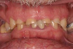 14jun26srrfroumdamimp01 14jun26srrfroumdamimp01