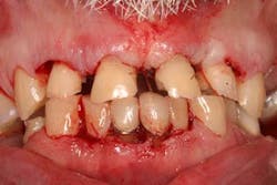 14jun26srrfroumdamimp02 14jun26srrfroumdamimp02