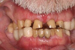 14jun26srrfroumdamimp03 14jun26srrfroumdamimp03