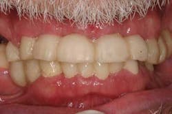 14jun26srrfroumdamimp03a 14jun26srrfroumdamimp03a