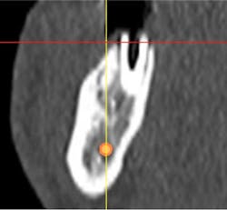 14jun26srrfroumdamimp05 14jun26srrfroumdamimp05