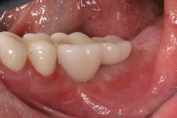 14jun26srrfroumdamimp08 14jun26srrfroumdamimp08