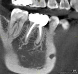 14mar13srrbeckavoidimpcomppart1fig01 14mar13srrbeckavoidimpcomppart1fig01