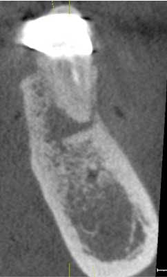 14mar13srrbeckavoidimpcomppart1fig02 14mar13srrbeckavoidimpcomppart1fig02