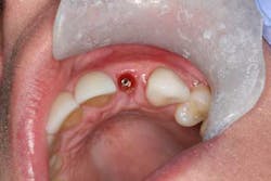 14mar13srrbeckavoidimpcomppart1fig04 14mar13srrbeckavoidimpcomppart1fig04