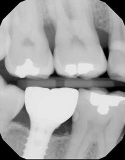 14mar13srrbeckavoidimpcomppart1fig05 14mar13srrbeckavoidimpcomppart1fig05