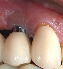 14mar27srrdoobrow01 14mar27srrdoobrow01