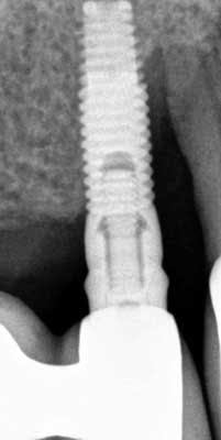 14mar27srrdoobrow02 14mar27srrdoobrow02