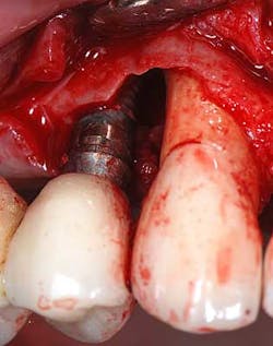 14mar27srrdoobrow03 14mar27srrdoobrow03