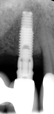 14mar27srrdoobrow04cropped 14mar27srrdoobrow04cropped