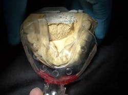 14may22srrfaginmandibtori01 14may22srrfaginmandibtori01