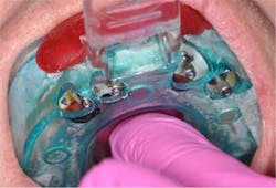 14may22srrfaginmandibtori02b 14may22srrfaginmandibtori02b