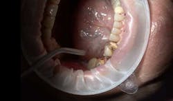 14may22srrfaginmandibtori03 14may22srrfaginmandibtori03