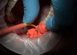 14may22srrfaginmandibtori04 14may22srrfaginmandibtori04