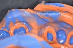 14may22srrfaginmandibtori08 14may22srrfaginmandibtori08