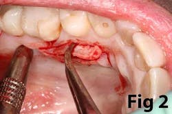 14may8srryoobear02 14may8srryoobear02