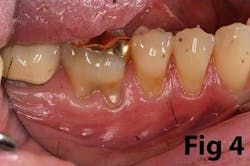 14may8srryoobear04 14may8srryoobear04