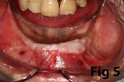 14may8srryoobear05 14may8srryoobear05