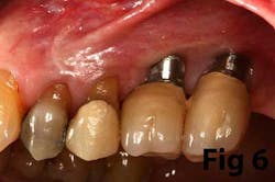 14may8srryoobear06 14may8srryoobear06