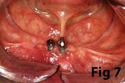 14may8srryoobear07 14may8srryoobear07