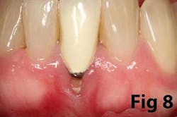 14may8srryoobear08 14may8srryoobear08