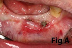 14may8srryoobeara 14may8srryoobeara