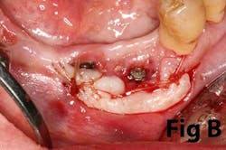 14may8srryoobearb 14may8srryoobearb