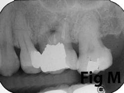 14may8srryoobearm 14may8srryoobearm